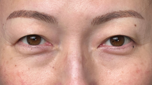 Postoperative Condition Part 1