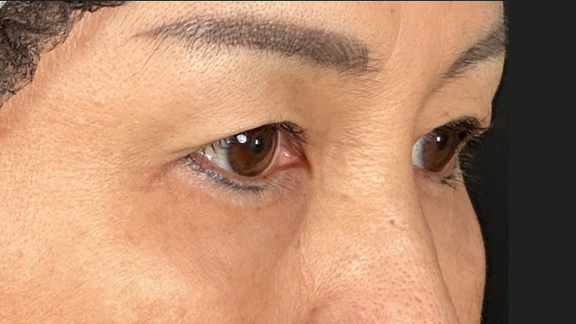 Postoperative Condition Part 1