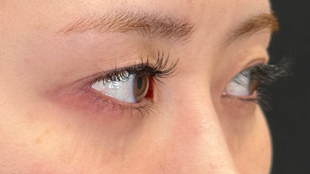 Postoperative Condition Part 1