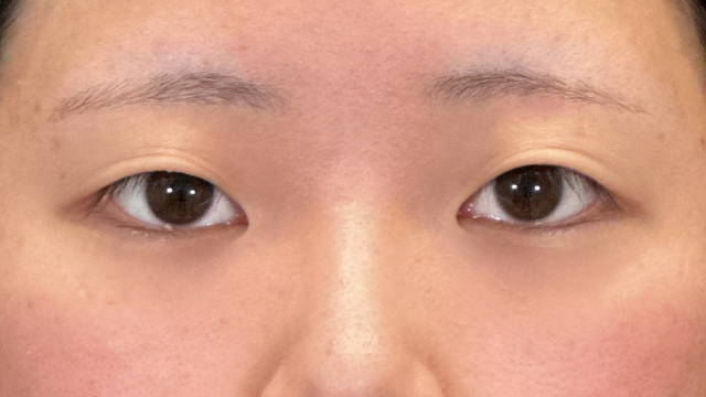 Postoperative Condition Part 1