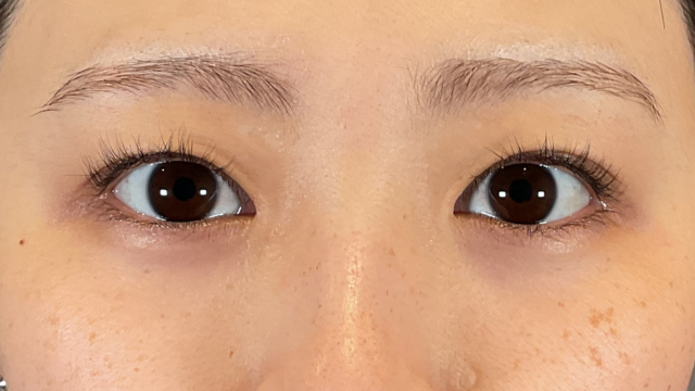 Postoperative Condition Part 1