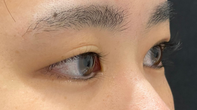 Postoperative Condition Part 1