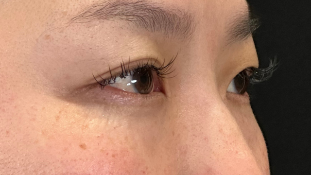 Postoperative Condition Part 1