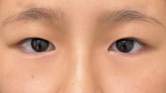 Postoperative Condition Part 1