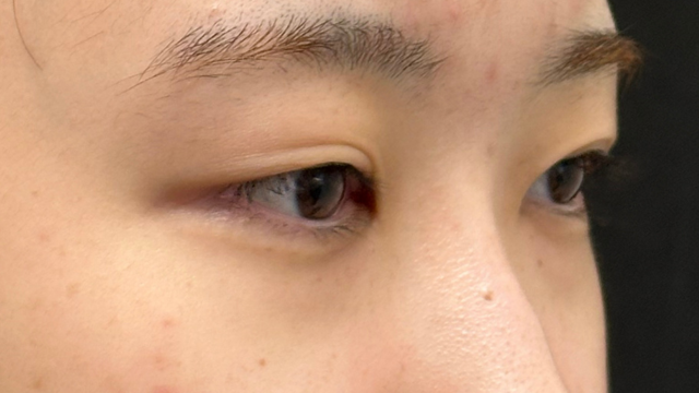 Postoperative Condition Part 1