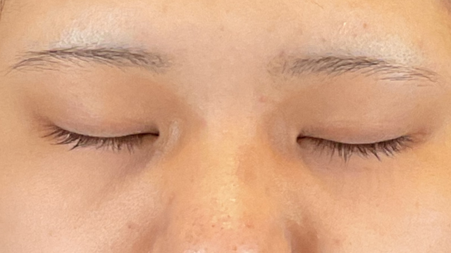 Postoperative Condition Part 1