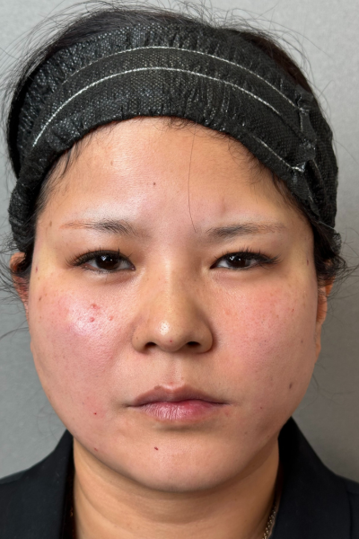 Postoperative Condition Part 1