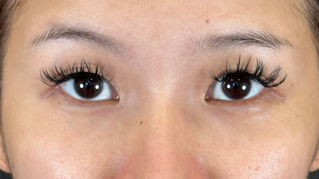 Postoperative Condition Part 1