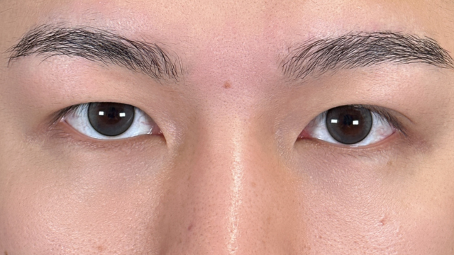 Postoperative Condition Part 1