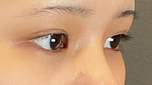 Postoperative Condition Part 1