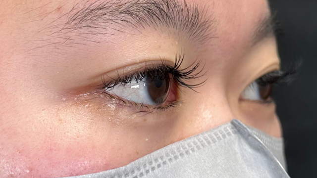 Postoperative Condition Part 1