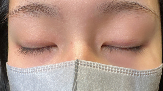 Postoperative Condition Part 1