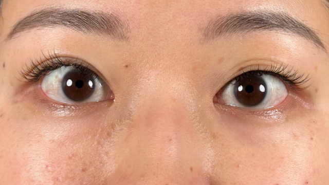 Postoperative Condition Part 1