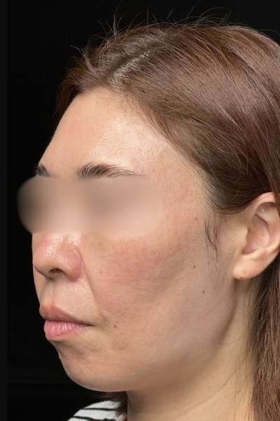 Postoperative Condition Part 1