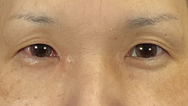 Postoperative Condition Part 1