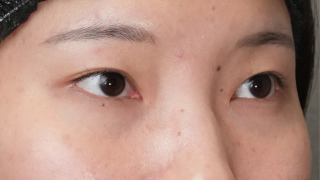 Postoperative Condition Part 1