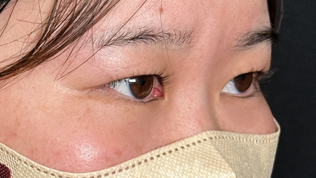 Postoperative Condition Part 1