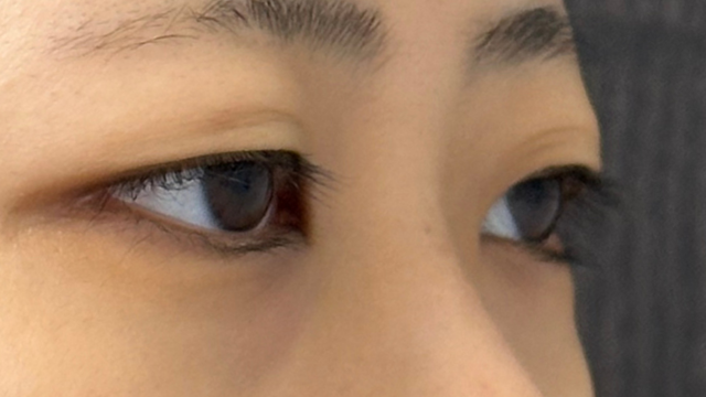 Postoperative Condition Part 1