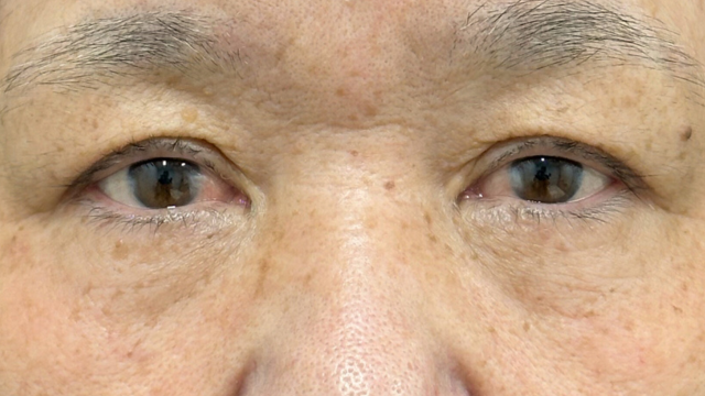 Postoperative Condition Part 1