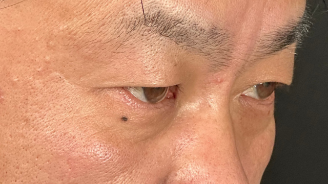 Postoperative Condition Part 1