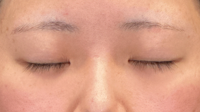 Postoperative Condition Part 1