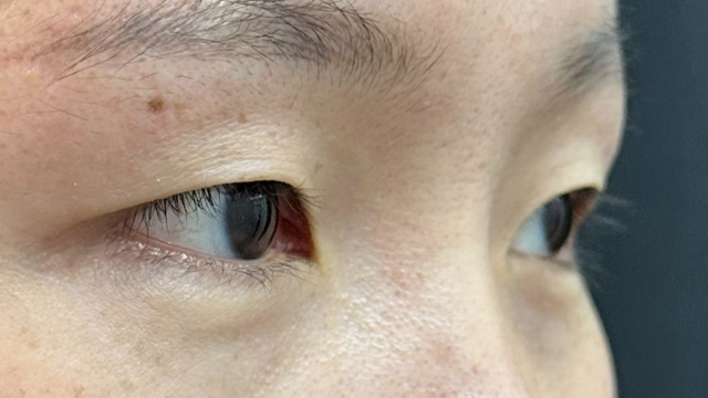 Postoperative Condition Part 1