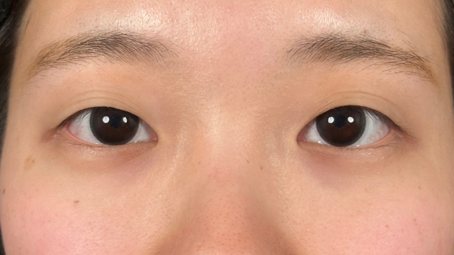 Postoperative Condition Part 1