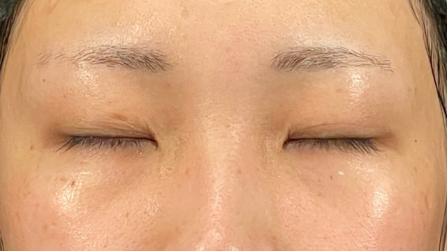 Postoperative Condition Part 1