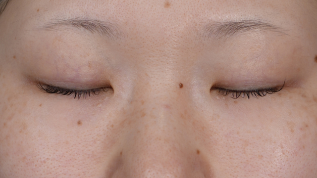 Postoperative Condition Part 1