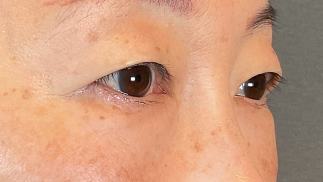 Postoperative Condition Part 1