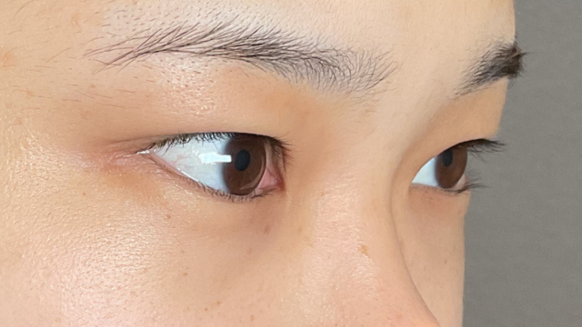 Postoperative Condition Part 1