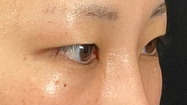 Postoperative Condition Part 1