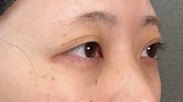 Postoperative Condition Part 1