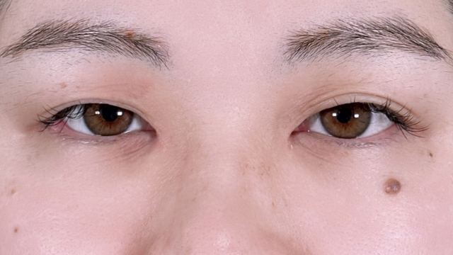 Postoperative Condition Part 1