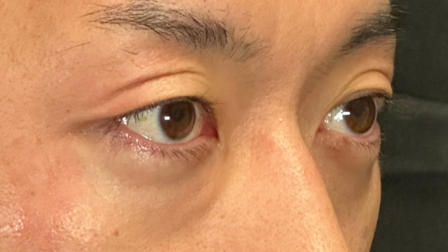 Postoperative Condition Part 1