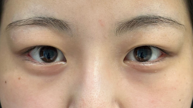 手术前的状态 其一