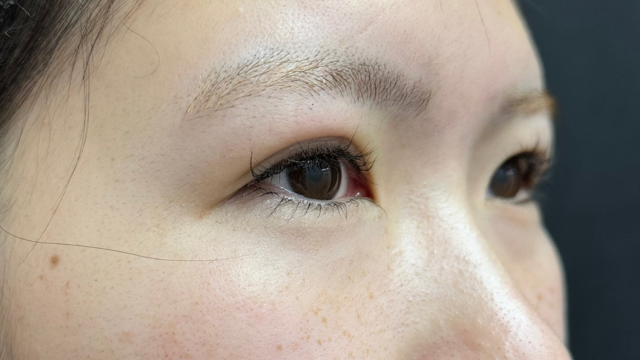 Postoperative Condition Part 1