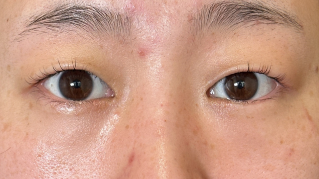 Postoperative Condition Part 1