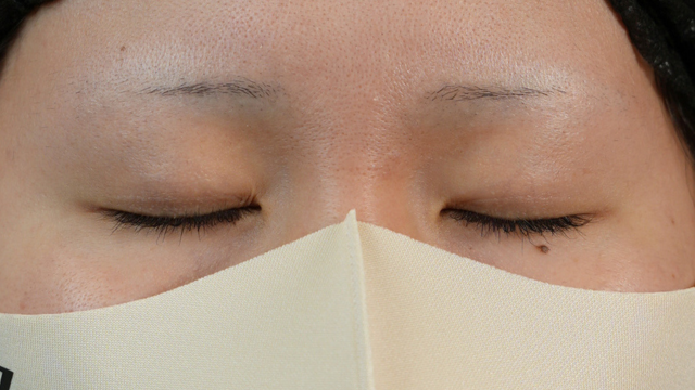 Postoperative Condition Part 1