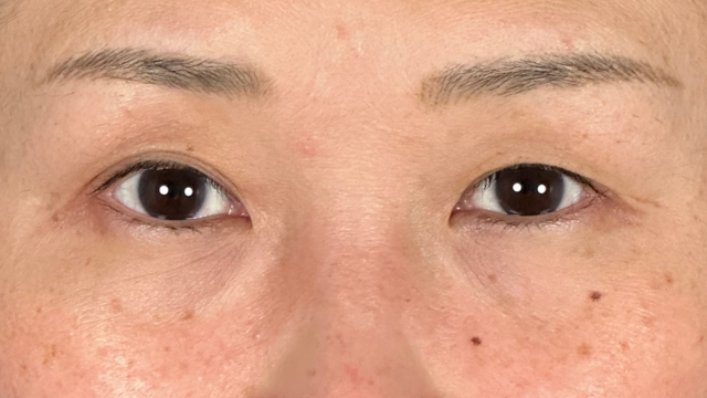 Postoperative Condition Part 1