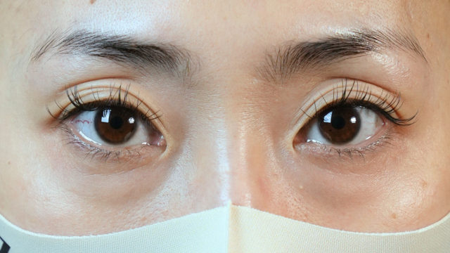 Postoperative Condition Part 1