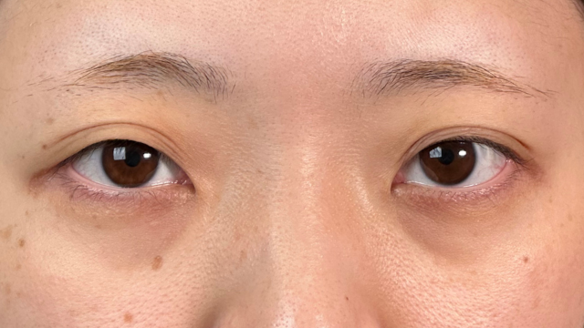 Postoperative Condition Part 1