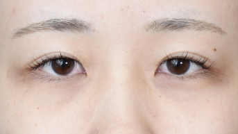 Postoperative Condition Part 1