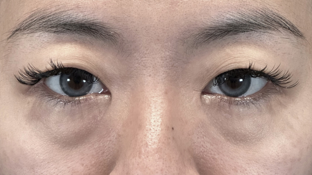 Postoperative Condition Part 1