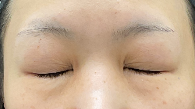 Postoperative Condition Part 1