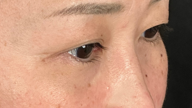 Postoperative Condition Part 1