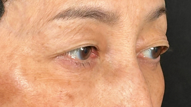 Postoperative Condition Part 1