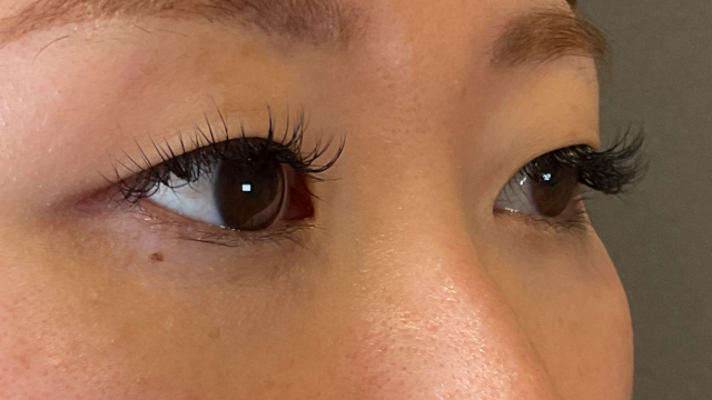 Postoperative Condition Part 1