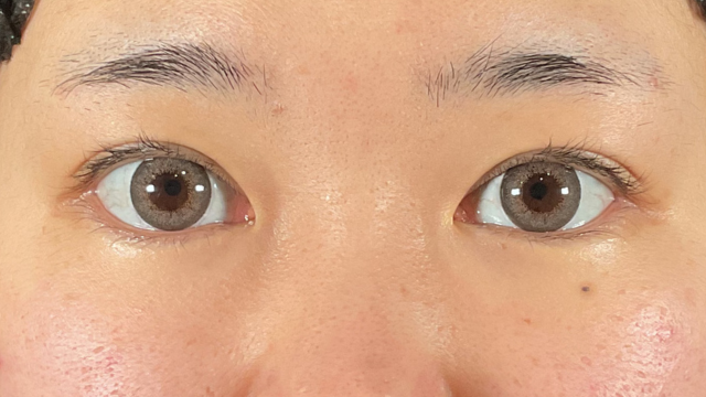 Postoperative Condition Part 1