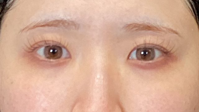 Postoperative Condition Part 1